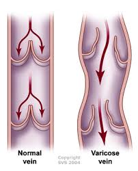 Vveins